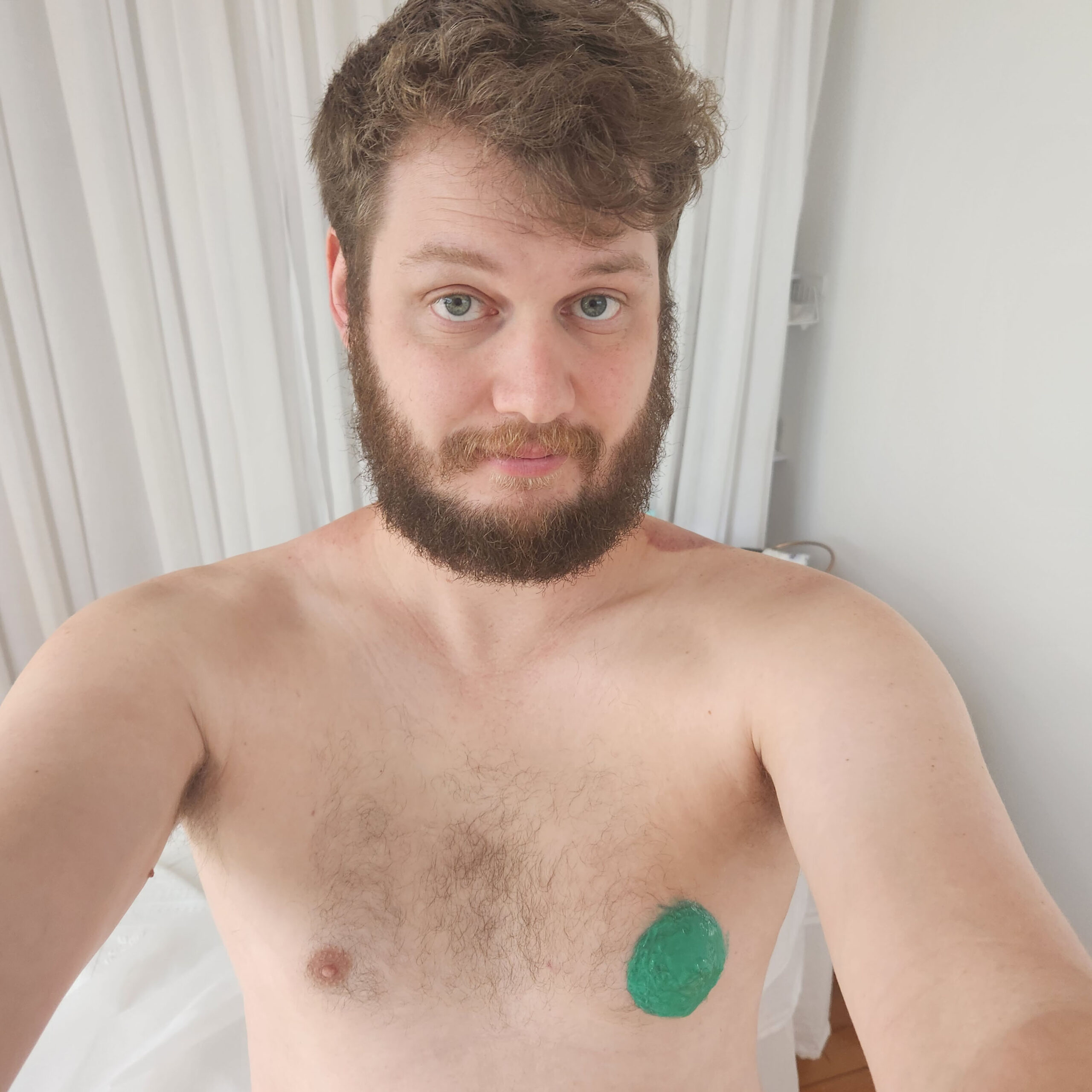 Me with the mould on my chest for the Donate Your Nipple campaign.